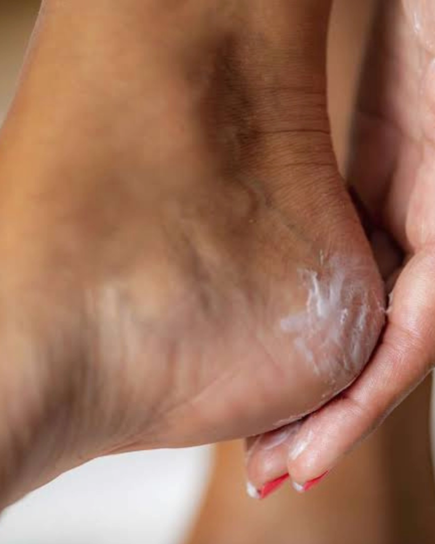 O que queremos saber: como cuidar dos pés para fazer trilhas!